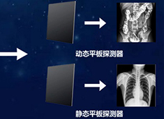 雙板DR與單板DR的區(qū)別：不止是多一個平板