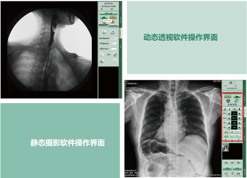 PLD8900動(dòng)態(tài)DR 動(dòng)靜態(tài)一體化軟件