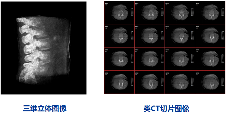 三維C型臂圖像