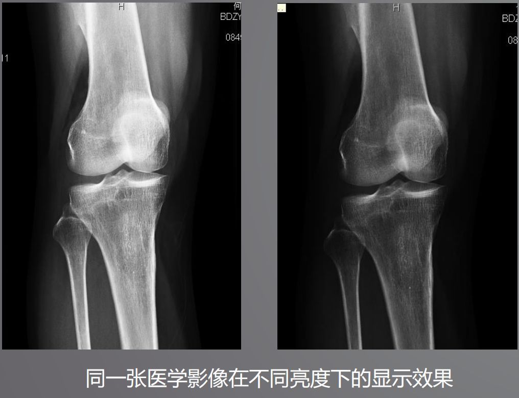 寵物DR設(shè)備的顯示器有要求？普通和醫(yī)用顯示器有什么區(qū)別