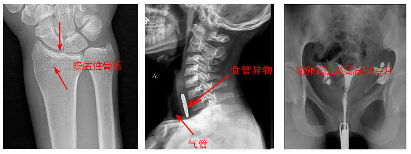 動態(tài)DR機準確點片