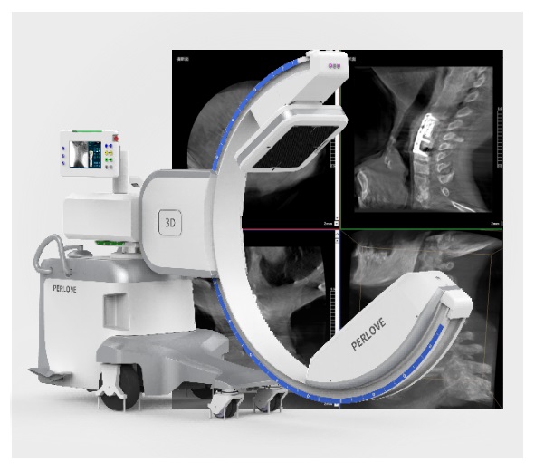 骨科C臂X光機(jī)